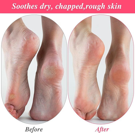 15Pairs Moisturizing Socks Overnight, Cotton Moisture Enhancing Socks, Spa Sock for Cracked Heel Repair, Spa Moisturizing Sock for Women and Men, White