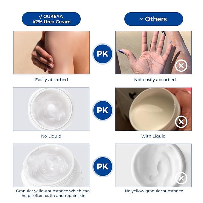 OUKEYA Urea Cream 42% plus Salicylic Acid 2% Net 350g Foot & Hand Cream for Dry Cracked, Urea Lotion for Feet Maximum Strength, 2 Pack