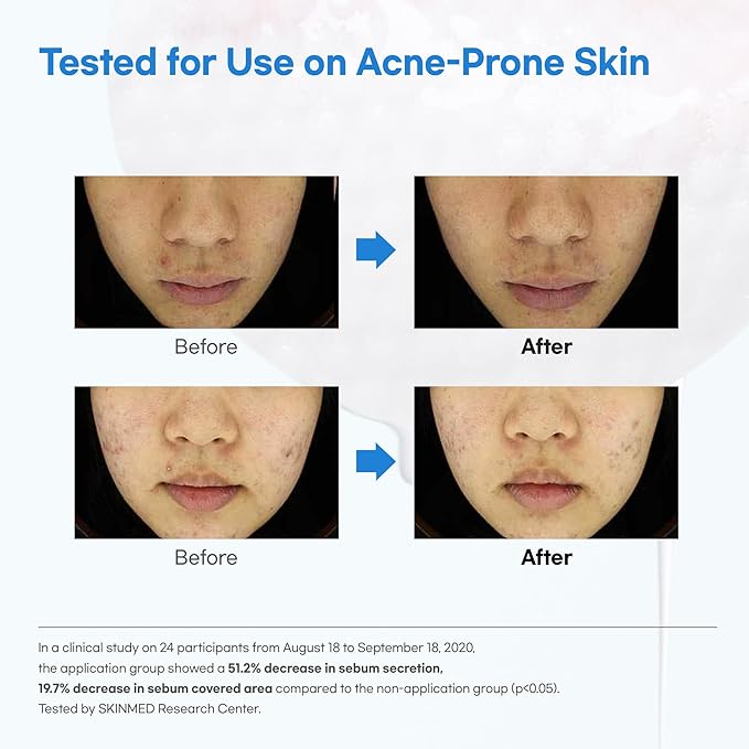 Witch Hazel Hyaluronic Toner Pad, Witch Hazel, Hyaluronic Acid, pH 5.5, 60 Pads