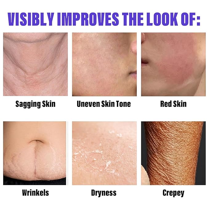 Get Dream Overnight Toning Whip 200mL/6.76oz - Anti-Wrinkle Body Firming Cream Cellulite Remover for Legs and Body - Anti Aging Skin Tightening Cream for Women Target Look Of Loose Skin