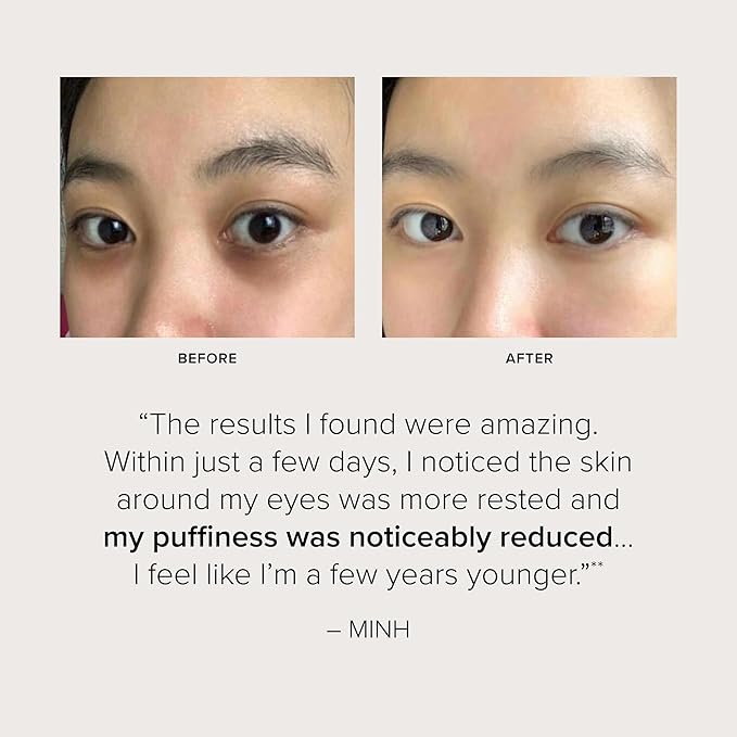 Serovital Beauty Dark Circle Eraser – Brightening & Anti‑Puffiness Under-Eye Treatment with Peptides, Dark Circle Corrector – eye corrector for dark circles - Hormone-Aware, Clinically Tested – 15mL