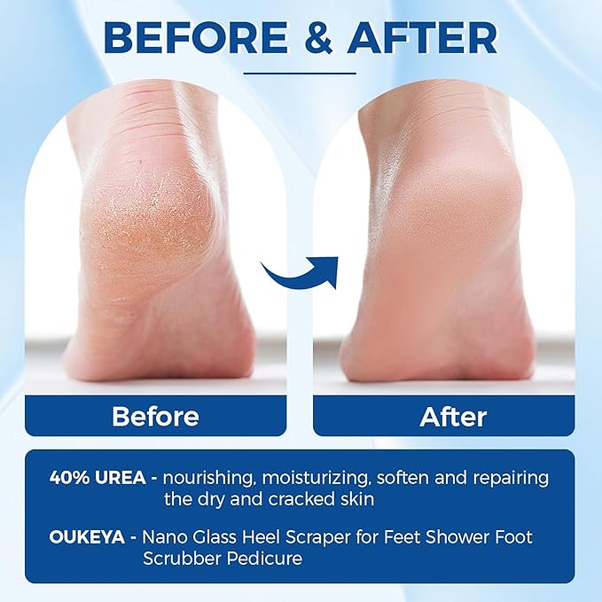 OUKEYA Urea Cream 40 Percent Tube, Urea Cream 40 Percent For Feet Maximum Strength, with Foot Callus Remover, Nano Glass Foot File