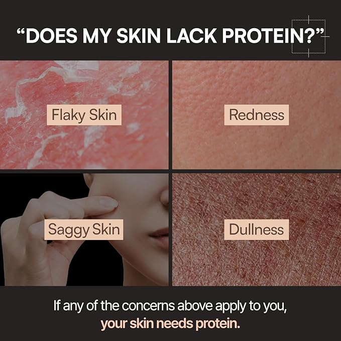 Milky Toner | Rice Enzyme Protein Toner | Skin Barrier Support, Hydration, Glow, Brightening | Oat and Rice Extract, Ceramide, Niacinamide | Dry, Flaky Skin | Korean Skincare | 8.5 fl.oz.