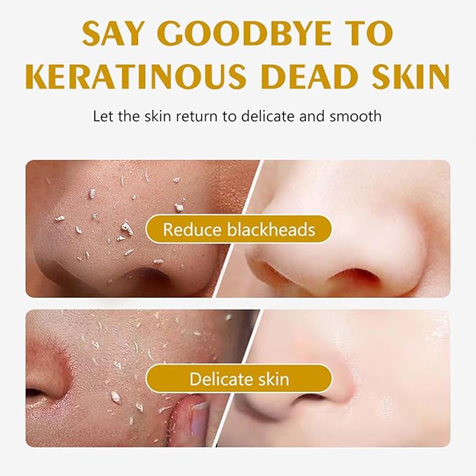 Lemon Exfoliating Gel,Peeling Gel Face Exfoliator,Removes Dead Cells,for Face & Body & Knee, Sebum Clear Pore Care, Soothing & Refreshing,Gently Daily Exfoliates For All Skin Types, 3.38 Oz