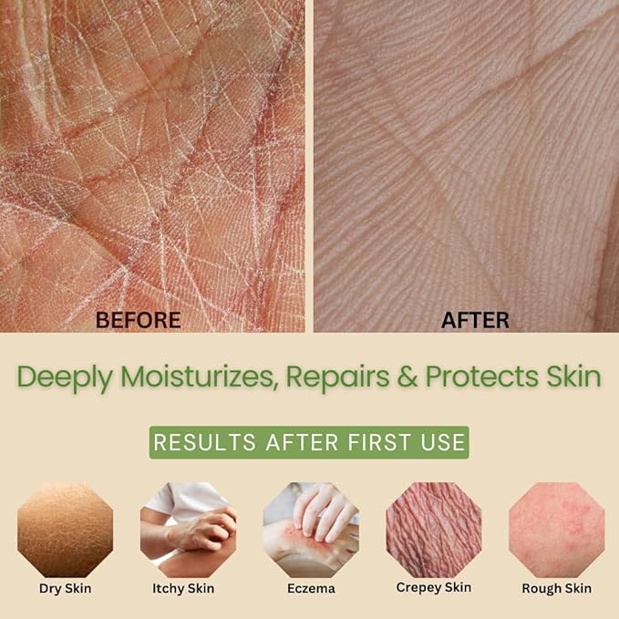 Lavender & Lemongrass Body Lotion 2-Pack – Hydrating Hand & Body Moisturizer for Dry Sensitive Skin – Vegan Plant-Based Lotion with Ceramides, Aloe Vera & Vitamins – 8oz Each