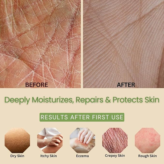 Lavender & Lemongrass Body Lotion 2-Pack – Hydrating Hand & Body Moisturizer for Dry Sensitive Skin – Vegan Plant-Based Lotion with Ceramides, Aloe Vera & Vitamins – 8oz Each