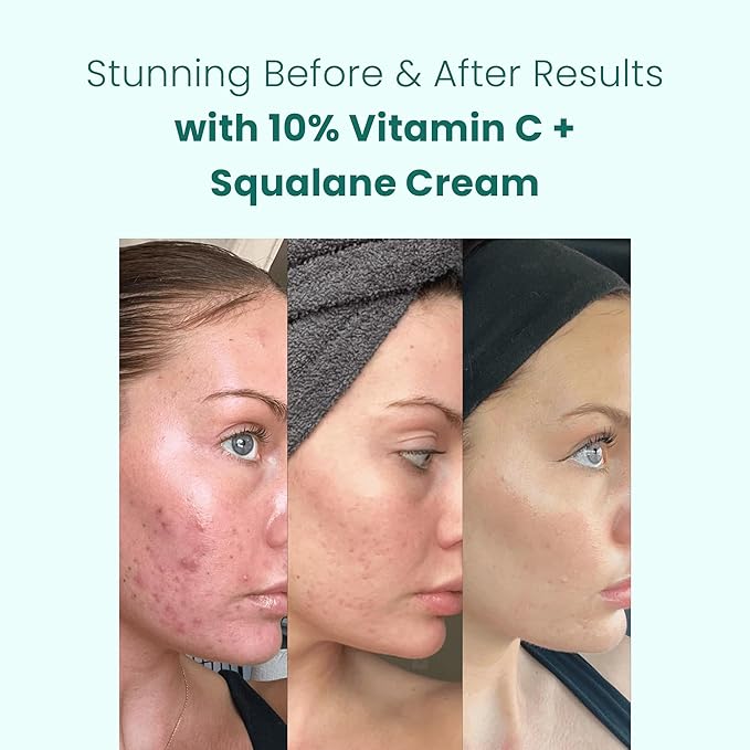 Gin Amber Beauty - Vitamin C (10%) + Squalane Repair Cream - Face Moisturizer - Facial Cream- Dark Spot Corrector - Primer - (30ml - 3-Packs)