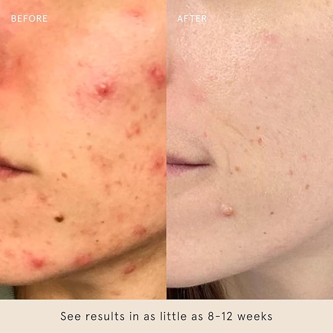 Barefaced Glow Duo - Glow Peel Pads & Toning Pads II for Exfoliated, Smoother, Brighter Skin