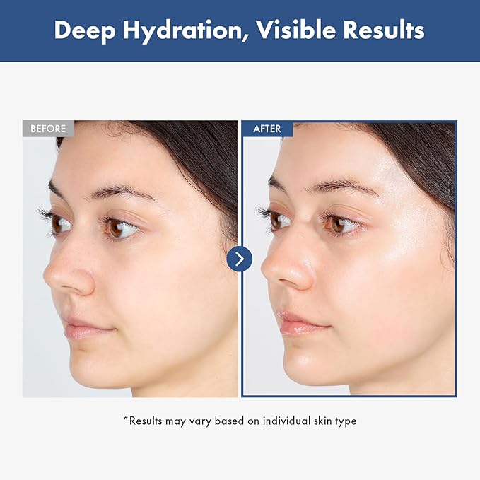 Hyaluronic Acid 3% Serum, 30,030ppm Sodium Hyaluronic Acid, Hydration, Moisture Boosting Facial Serum for Fine Lines & Wrinkles, Plump & Repair Dry Skin, Korean Skin Care, 30ml, 1.01 fl.oz.