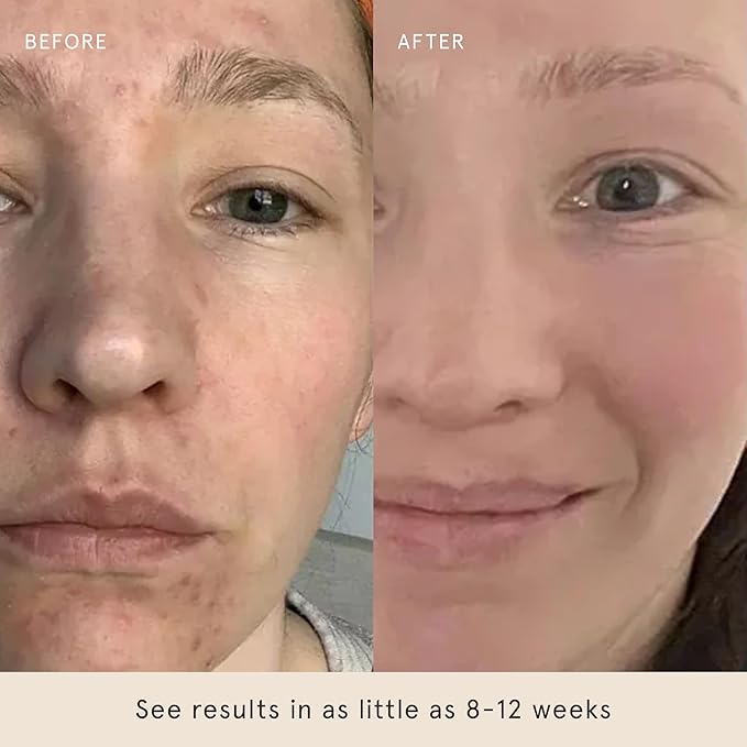 Barefaced Glow Duo - Glow Peel Pads & Toning Pads II for Exfoliated, Smoother, Brighter Skin