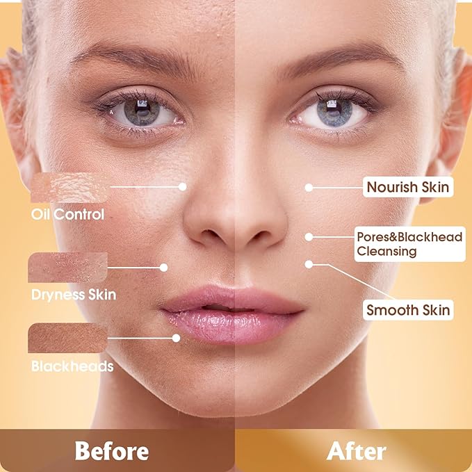 4 Pack Clay Mask, Vitamin C Turmeric Dead Sea Mud Facial Mask, Rose, Green Tea Clay Masque Set - Weekly Self Care Spa Gift for Women and Men, Skincare for Deep Cleansing Pore Minimizing Face Treatment