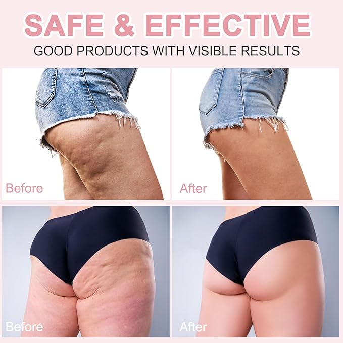 Butt Tight Lift Cream - Firm and Smooth Skin On The Booty, Reduce Loose and Crepey Skin, Moisten and Soften, Reduce The Appearance Of Cellulite 100ml