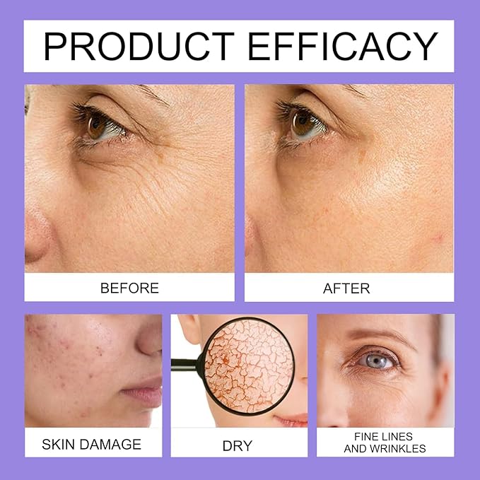 Get Dream Overnight Toning Whip: Body Firming Cream Cellulite Remover for Legs and Body – Loose Skin, Anti-Wrinkle Skin Tightening Gel with Caffeine & Vitamin C