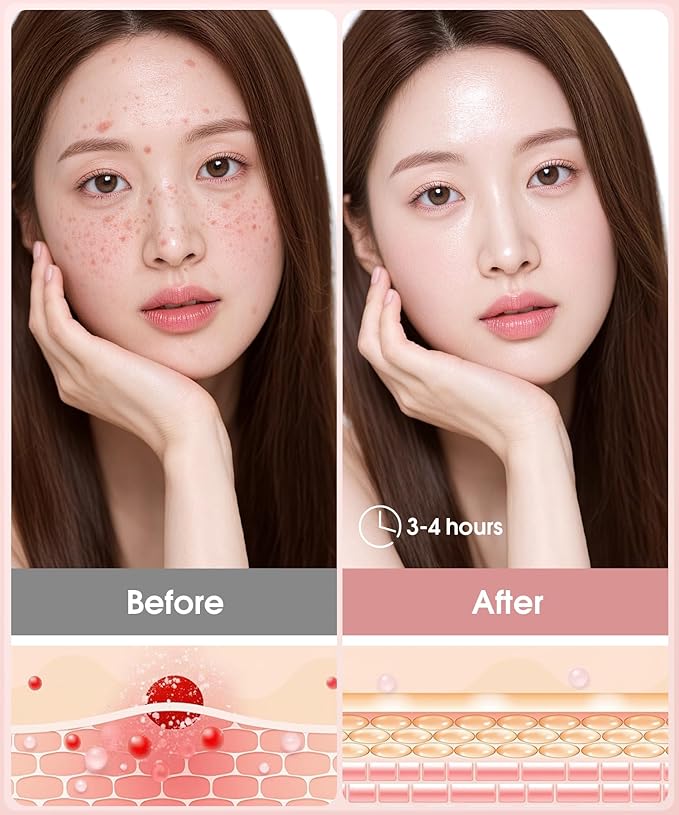 Bio-Collagen Face Mask - Korean Skincare, Women's Facial Treatments & Masks, Deep Hydrating Overnight Mask, Firming & Moisturizing, 6-Pack