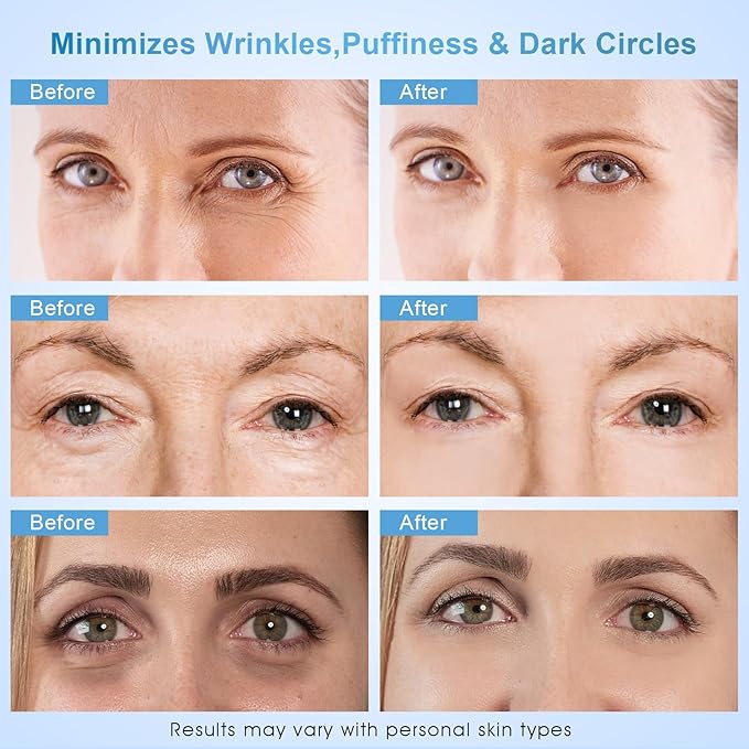 Dongyu Anti-Aging Eye Cream for Wrinkles: Under Eye Cream with Snail Mucin Caffeine for Fine Lines Puffiness - Firming Eye Serum for Women