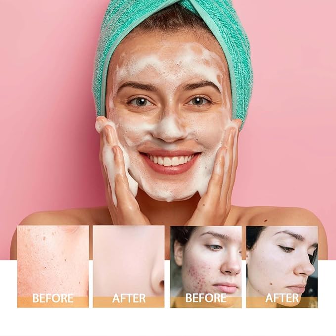 Turmeric Face Wash with Brush, Turmeric Foaming Facial Cleanser for All Skin, 3.38 Fl Oz/pcs