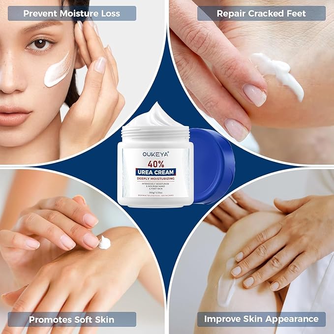 OUKEYA Urea Cream 40 Percent, Foot & Hand Cream for Dry Cracked, Urea Lotion for Feet Maximum Strength(12.35Oz X 2 Packs)