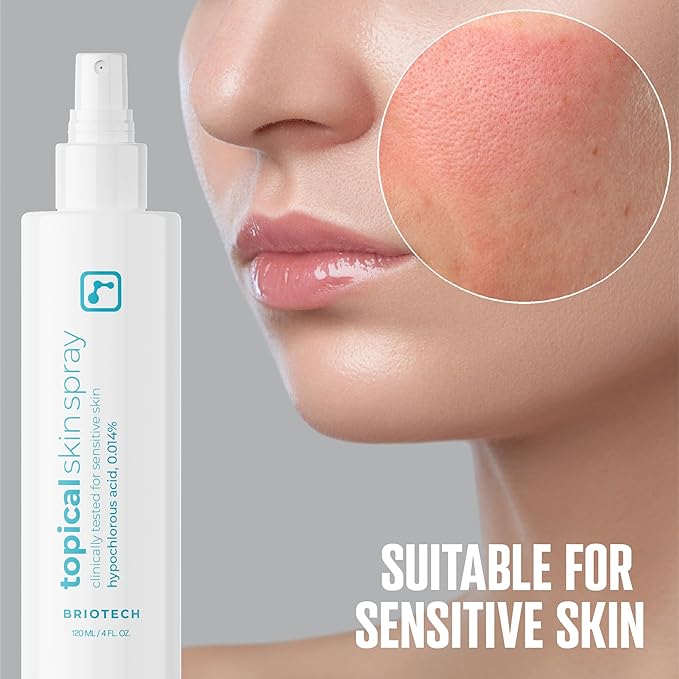 BRIOTECH Topical Skin Spray, Hypochlorous Acid Spray for Sensitive Skin, HOCl Facial Mist, Full Body Support Against Irritation, Calm Redness, Soothe Foot & Scalp, 2 oz Travel Size (2 Pack)