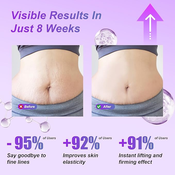 Get Dreamy Overnight Toning Whip, Skin Tightening Cream for Body, Body Firming for Women That Works While You Sleep, Skin Tightening Cellulite Cream Suitable for All Skin Types