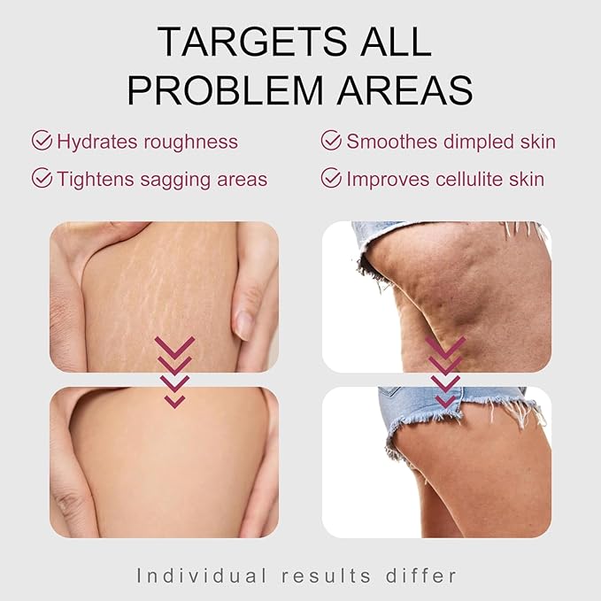 B-TIGHT Body Cream, 200ml Leave-On Booty Enhancing Mask, Moisturizing Cream, Leave-On Cellulite Mask - Tightens Sagging Skin, Enhances Elasticity for a Toned Appearance