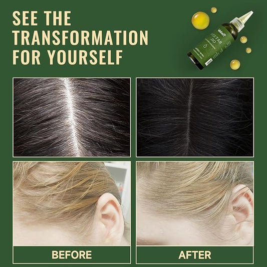 Batana Oil - Dr Sebi Organic Oil for Hair Growth, 100% Raw Pure Natural from Honduras, Deeply Nourishing Scalp for Thicker & Stronger Hair, 4.05 fl oz