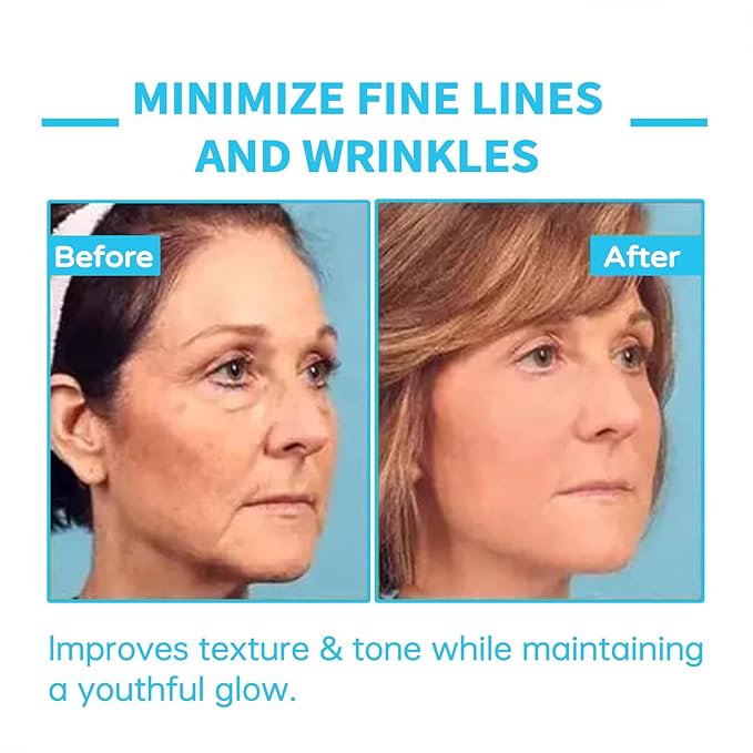 Lovilds Skin Tightener, Advanced Firming & Wrinkle-Reducing Cream, Lovilds Skin Firming Rejuvenating Cream, Skin Firming, Moisturizing and Anti-Wrinkle for all Skin Types (4 Bottle)