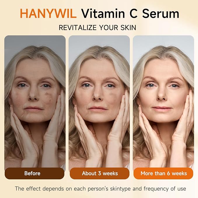 HANYWIL Super Vitamin C Serum for Women over 70, Vitamin C Serum for Face, Dark Spot Remover for Face, Hyaluronic Acid Skin Care, Targets Age Spots, Hydrates and Wrinkle Reduction 1.7fl oz