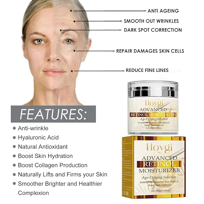 Advanced Retinol Moisturizer, Anti-Aging Cream with Hyaluronic Acid, Vitamin E, Green Tea & Jojoba Oil for Wrinkles, Hydrating and Improving Skin Elasticity - All Skin Type -1.7 Oz