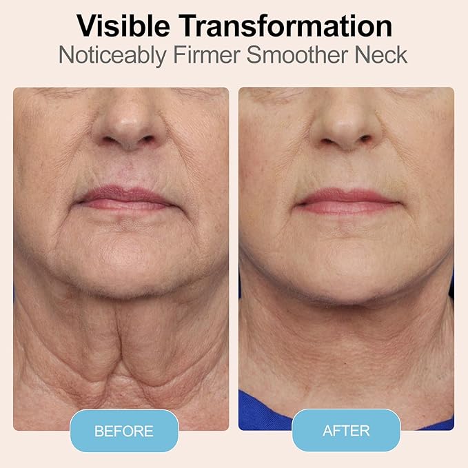 1 Pack Silicone Neck Wrinkle Patch, Reusable Anti-Aging Silicone Pad for Neck Wrinkle Smoothing & Skin Firming (1-Month Supply)