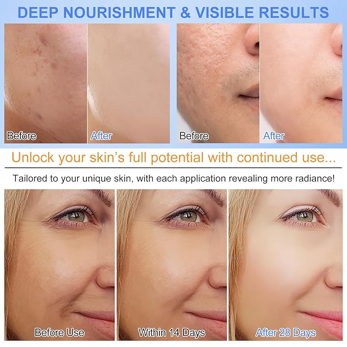 collagen mask,face masks skincare Firming Collagen Mask with Collagen Peptides for Anti-Aging,Facial Hydrogel Masks with low molecular weight collagen for elasticity and moisturizing 12pcs