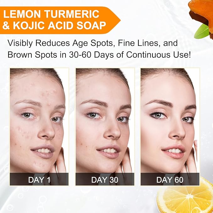 Lemon Turmeric Kojic Acid Soap - Organic Turmeric Dark Spot Remover Soap Bar for Face and Body - Kojic Acid Skin Care for All Skin Types, Deep Cleansing