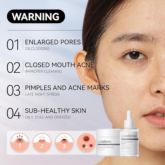 LANBENA 3-in-1 Blackhead Removal Set - Pore Strips (30g), Pore Minimizing Serum (30ml) & Removal Paper - Mask for Face, Minimizes Pores & Leaves Skin Fresh & Clean, Blackhead Remover