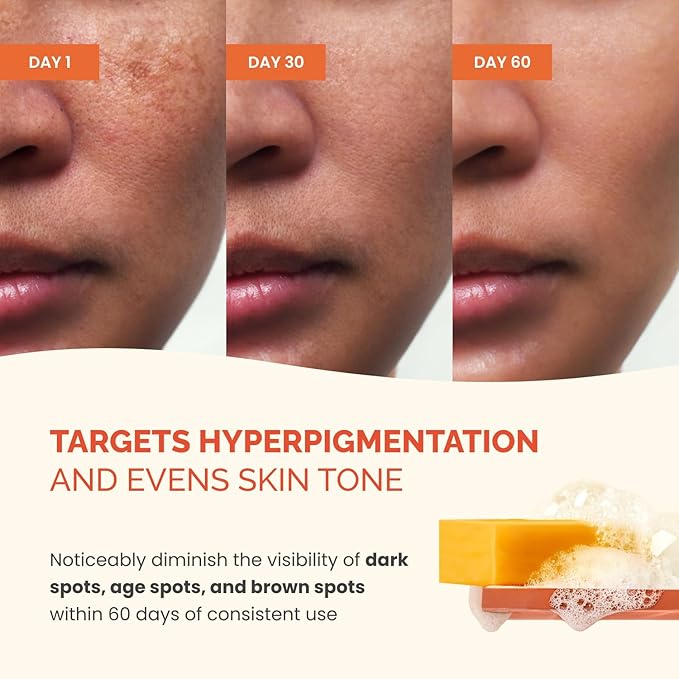 PLANTIFIQUE Kojic Acid Soap for Hyperpigmentation 4 Bars with Mesh Bag - Turmenic Soap with Hyaluronic Acid, Collagen, Vitamin C for Dark Spots - Vegan Skincare, 320g / 11.28 oz