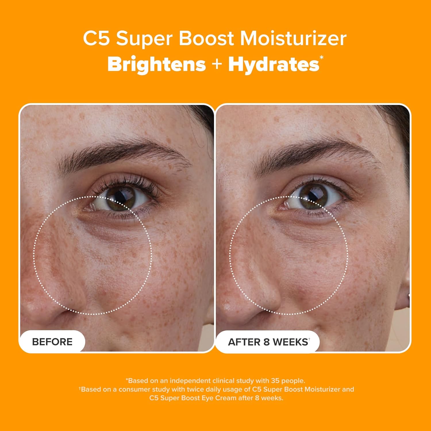 C5 Super Boost Vitamin C Moisturizer – 5% Stabilized Vitamin C + Squalane | Brightening Face Lotion for Uneven Skin Tone, Discoloration, Fine Lines & Acne-Prone Skin | Daily Fragrance-Free Anti-Aging Cream