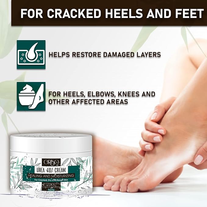 Urea Cream 40 Percent - Intensive Hydration for Dry and Cracked Heels, Feet, Hands, Elbows and Knees - Callus Remover for Women with Salicylic Acid - Helps Athletes Foot - Foot Odor - 4 oz