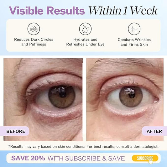 LilyAna Naturals Eye Cream for Dark Circles and Puffiness, Under Eye Cream for Wrinkles and Bags, Anti Aging - helps Improve Dryness; for Sensitive Skin - 1.7 oz - Made in USA