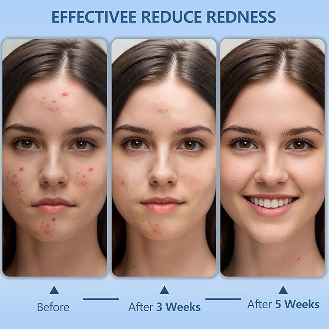 Disposable Face Towels Travel, 12"×12" Extra Large Face Towelettes, Ultra Soft Facial Towels for Sensitive Skin, Makeup Remover Dry Wipes, 20 Count (1 Pack)