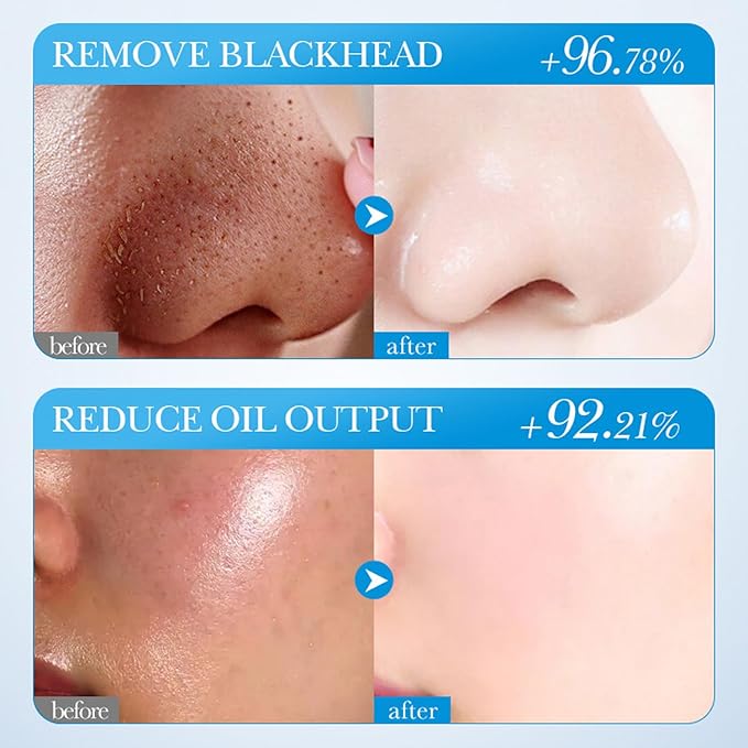 3PCS Green Tea Face Mask, Turmeric Clay Mask Rose Stick For Face, Deep Cleanse Stick Clay Blackhead Remover Poreless For Moisturizing, Oil Control For All Skin Types