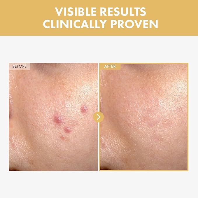 Black Snail Ginseng Serum, Ginseng 640,430ppm, Snail Mucin, Hydrating Facial Moisturizer, Acne Scar Remover, Self Care, Glow Skin Under Makeup, Korean Skin Care, 30ml, 1.01 fl. oz.