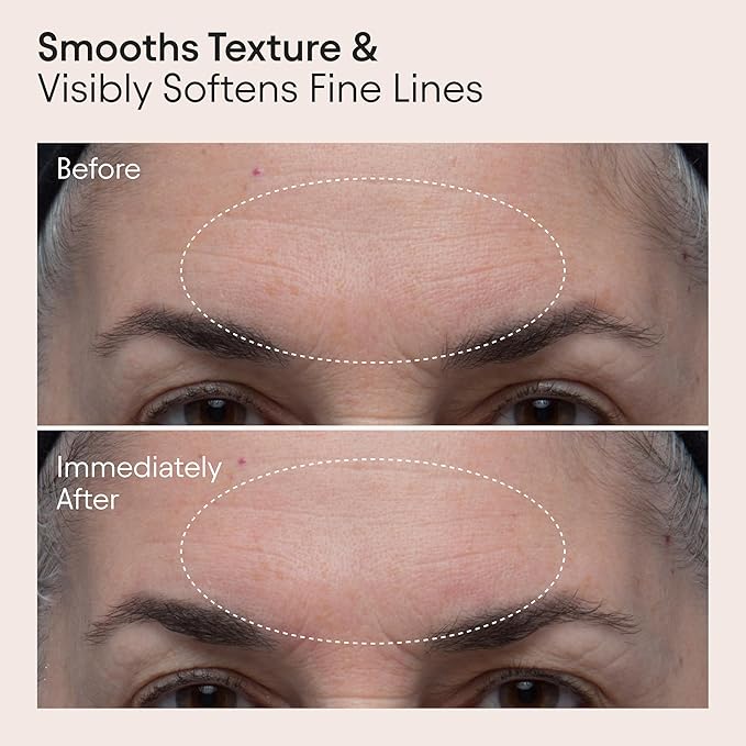 ALPYN Double Polishing Peel & Brightening Face Mask | Visibly Smooth & Brighten Skin While Refining the Look of Pores | 1.7 oz / 50 ml