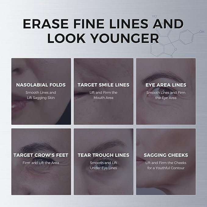 Smile Line & Under Eye Patches – 4-Peptide Anti-Wrinkle Treatment with Collagen, Caffeine & Niacinamide – Firming, Hydrating, Brightening Face Pads for Laugh Lines, Eye Bags, 10 Pairs