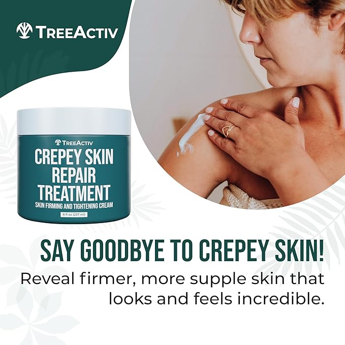 TreeActiv Crepey Skin Repair Treatment, 8oz, Firming Cream with Hyaluronic Acid & Shea Butter to Deeply Moisturize & Tighten Wrinkly Dry Crepe Skin, 500+ Uses