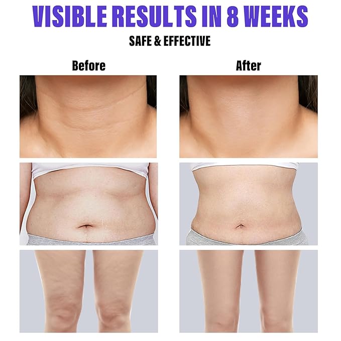 Get Dream Overnight Toning Whip 200mL/6.76oz - Anti-Wrinkle Body Firming Cream Cellulite Remover for Legs and Body - Anti Aging Skin Tightening Cream for Women Target Look Of Loose Skin