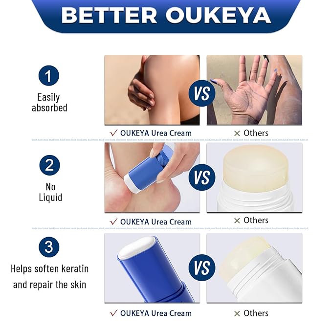 OUKEYA Urea Cream 40 Percent.Urea Cream Stick for Foot and Hand Cream Stick for Dry Cracked, Cracked Heel, Avoid Frostbite, 40 Percent Urea Lotion for Feet Maximum Strength, 2 PACK