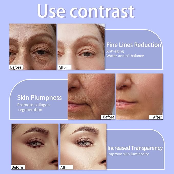 Dewy Skin Cream Face Moisturizer Water Cream for Women with Purple Rice & Hyaluronic Acid - Rich Face Cream to Hydrate, Plump and Protect Dry and Combo Skin 50ml/1.7 fl oz