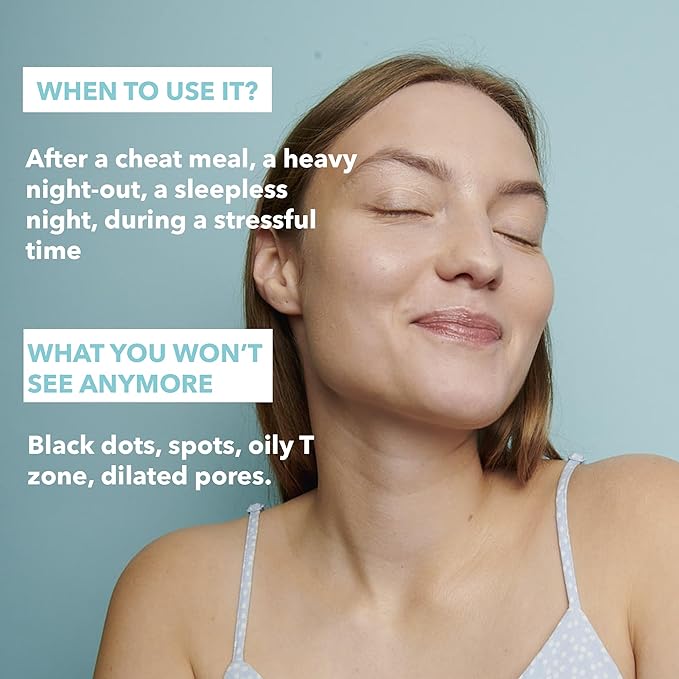 Carbone Glacé - Purifying Carbon Black Facial Sheet Mask - Cleanses & Tightens - With Hamamelis & Mallow - Purifying, Firming & Revitalizing - Multi-Active Serum Formula - 5 Pack