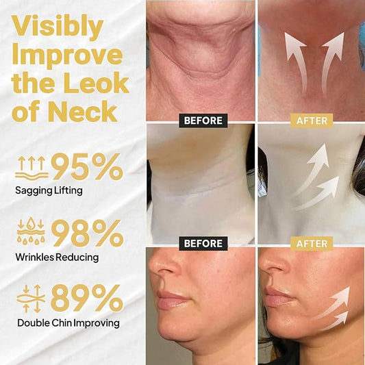 LOVILDS Skin Tightener, LOVILDS Skin Firming Cream, Skin Firming Rejuvenating Cream for All skin Types (2 Bottle)