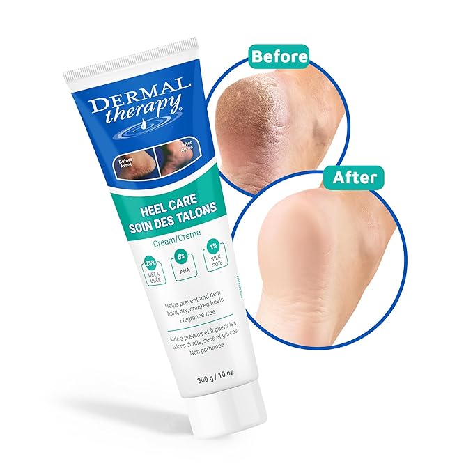 Dermal Therapy - Heel Care Cream, Foot Cream for Dry Cracked Heels, Intense Foot Moisturizer with Urea and AHA, Foot Lotion with Non-Greasy Formula, 300g