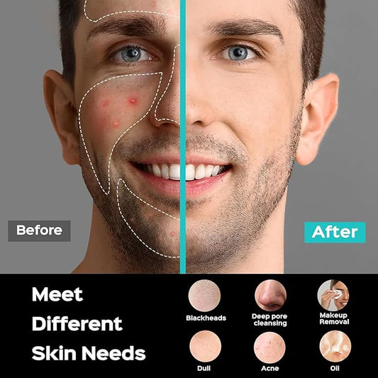 COSLUS Face Scrubber Facial Cleansing Brush: 5 Cleansing Modes Silicone Face Wash Scrubber for Men Beard Care, Sensitive Skin - Deep Cleansing & Gentle Exfoliating, Portable for Shower & Travel