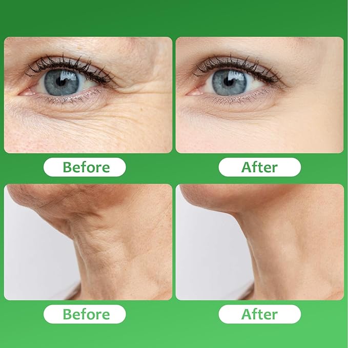 Beef Tallow for Skin, 100% Organic Grass-Fed Whipped Beef Tallow & Honey Balm, Deeply Moisturizing Face & Body Cream for All Skin Types, 2.12 OZ